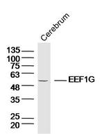 EEF1G Antibody in Western Blot (WB)