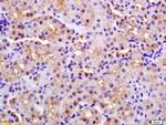 PARK7 Antibody in Immunohistochemistry (Paraffin) (IHC (P))