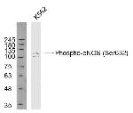 Phospho-eNOS (Ser633) Antibody in Western Blot (WB)