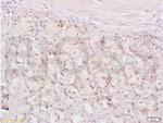 XAF1 Antibody in Immunohistochemistry (Paraffin) (IHC (P))