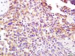 CD138/Syndecan 1 Antibody in Immunohistochemistry (Paraffin) (IHC (P))