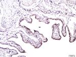 CD138/Syndecan 1 Antibody in Immunohistochemistry (Paraffin) (IHC (P))