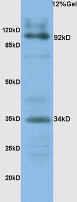 CD138/Syndecan 1 Antibody in Western Blot (WB)