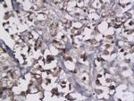 LYVE-1 Antibody in Immunohistochemistry (Paraffin) (IHC (P))