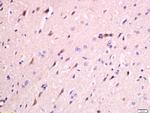 FAM134B Antibody in Immunohistochemistry (Paraffin) (IHC (P))