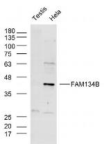 FAM134B Antibody in Western Blot (WB)