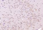 FBXO45 Antibody in Immunohistochemistry (Paraffin) (IHC (P))