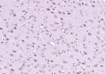 FBXO45 Antibody in Immunohistochemistry (Paraffin) (IHC (P))