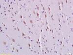 PDGFBB Antibody in Immunohistochemistry (Paraffin) (IHC (P))