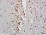 STAT1 Antibody in Immunohistochemistry (Paraffin) (IHC (P))