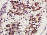 Frizzled 4/CD344 Antibody in Immunohistochemistry (Paraffin) (IHC (P))