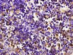 Furin Antibody in Immunohistochemistry (Paraffin) (IHC (P))