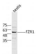 FZR1/CDC20C Antibody in Western Blot (WB)