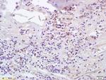 CCL5/RANTES Antibody in Immunohistochemistry (Paraffin) (IHC (P))