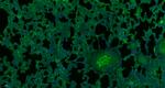 GAA Antibody in Immunohistochemistry (Paraffin) (IHC (P))