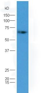 GAD65 + GAD67 Antibody in Western Blot (WB)