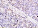 Metallothionein Antibody in Immunohistochemistry (Paraffin) (IHC (P))