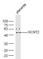 GCNT2 Antibody in Western Blot (WB)