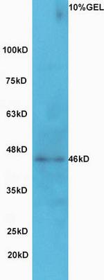 GCNT2 Antibody in Western Blot (WB)