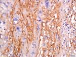 sFRP-4 Antibody in Immunohistochemistry (Paraffin) (IHC (P))