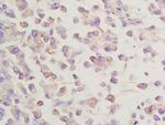 GGA2 Antibody in Immunohistochemistry (Paraffin) (IHC (P))