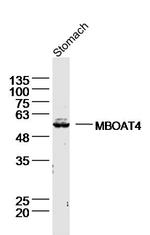 MBOAT4/Ghrelin O acyltransferase Antibody in Western Blot (WB)