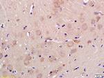 GLS2 Antibody in Immunohistochemistry (Paraffin) (IHC (P))