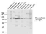 Glucocorticoid Receptor beta Antibody in Western Blot (WB)