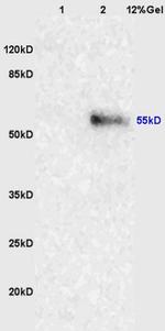 NRF-1 Antibody in Western Blot (WB)