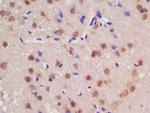 Guanylyl Cyclase alpha 1 Antibody in Immunohistochemistry (Paraffin) (IHC (P))