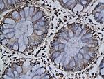 Apolipoprotein J Antibody in Immunohistochemistry (Paraffin) (IHC (P))