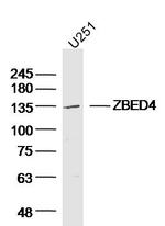 ZBED4 Antibody in Western Blot (WB)