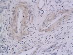 Integrin Alpha V + Beta 5 Antibody in Immunohistochemistry (Paraffin) (IHC (P))