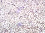 Integrin Alpha V + Beta 5 Antibody in Immunohistochemistry (Paraffin) (IHC (P))