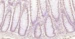 ZMYM2/ZNF198 Antibody in Immunohistochemistry (Paraffin) (IHC (P))