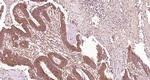 CLEC9A Antibody in Immunohistochemistry (Paraffin) (IHC (P))