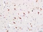 Optineurin Antibody in Immunohistochemistry (Paraffin) (IHC (P))