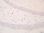 Optineurin Antibody in Immunohistochemistry (Paraffin) (IHC (P))