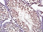 Optineurin Antibody in Immunohistochemistry (Paraffin) (IHC (P))