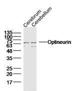 Optineurin Antibody in Western Blot (WB)