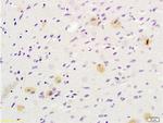 Tsg101 Antibody in Immunohistochemistry (Paraffin) (IHC (P))