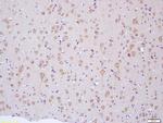 NF2/Neurofibromin 2 Antibody in Immunohistochemistry (Paraffin) (IHC (P))