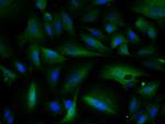 ATM Antibody in Immunocytochemistry (ICC/IF)