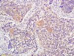 ATM Antibody in Immunohistochemistry (Paraffin) (IHC (P))