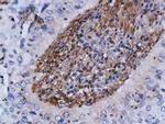 ATM Antibody in Immunohistochemistry (Paraffin) (IHC (P))