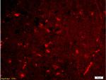 Lipocalin 2 Antibody in Immunohistochemistry (Paraffin) (IHC (P))