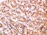 CD99L2 Antibody in Immunohistochemistry (Paraffin) (IHC (P))