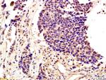 SLUG Antibody in Immunohistochemistry (Paraffin) (IHC (P))