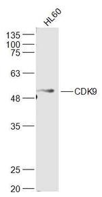 CDK9 Antibody in Western Blot (WB)