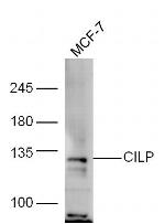 CILP Antibody in Western Blot (WB)